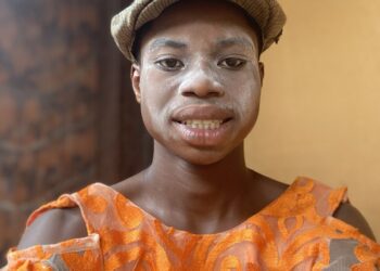 TikTok Star Peller Opens up About Family Struggles at 19