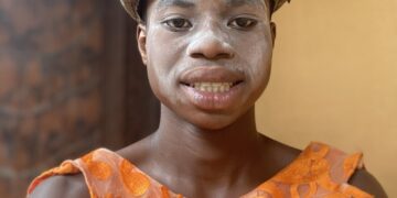 TikTok Star Peller Opens up About Family Struggles at 19