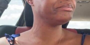 EFCC Opens Case As Family Accuses Blessing CEO of ₦300m Cancer Fund Fraud